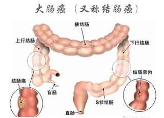 百万网红咖啡师的抗癌抉择，勇气与放弃化疗的选择