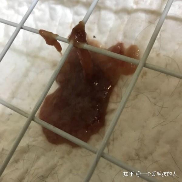 小伙腹泻两周背后的真相，神秘鬼脸虫感染揭秘