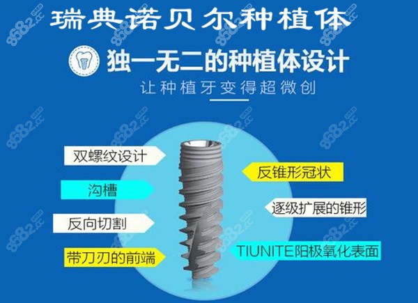 诺贝尔种植体型号价格信息